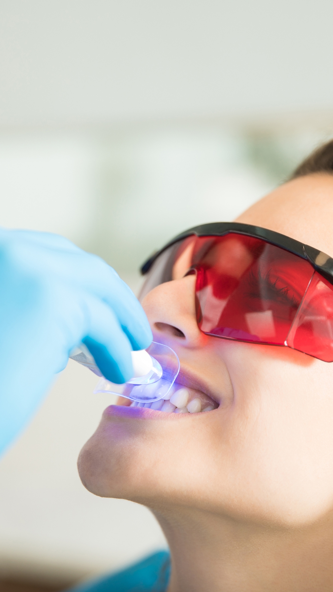 Teeth Whitening