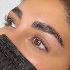 brow-lift