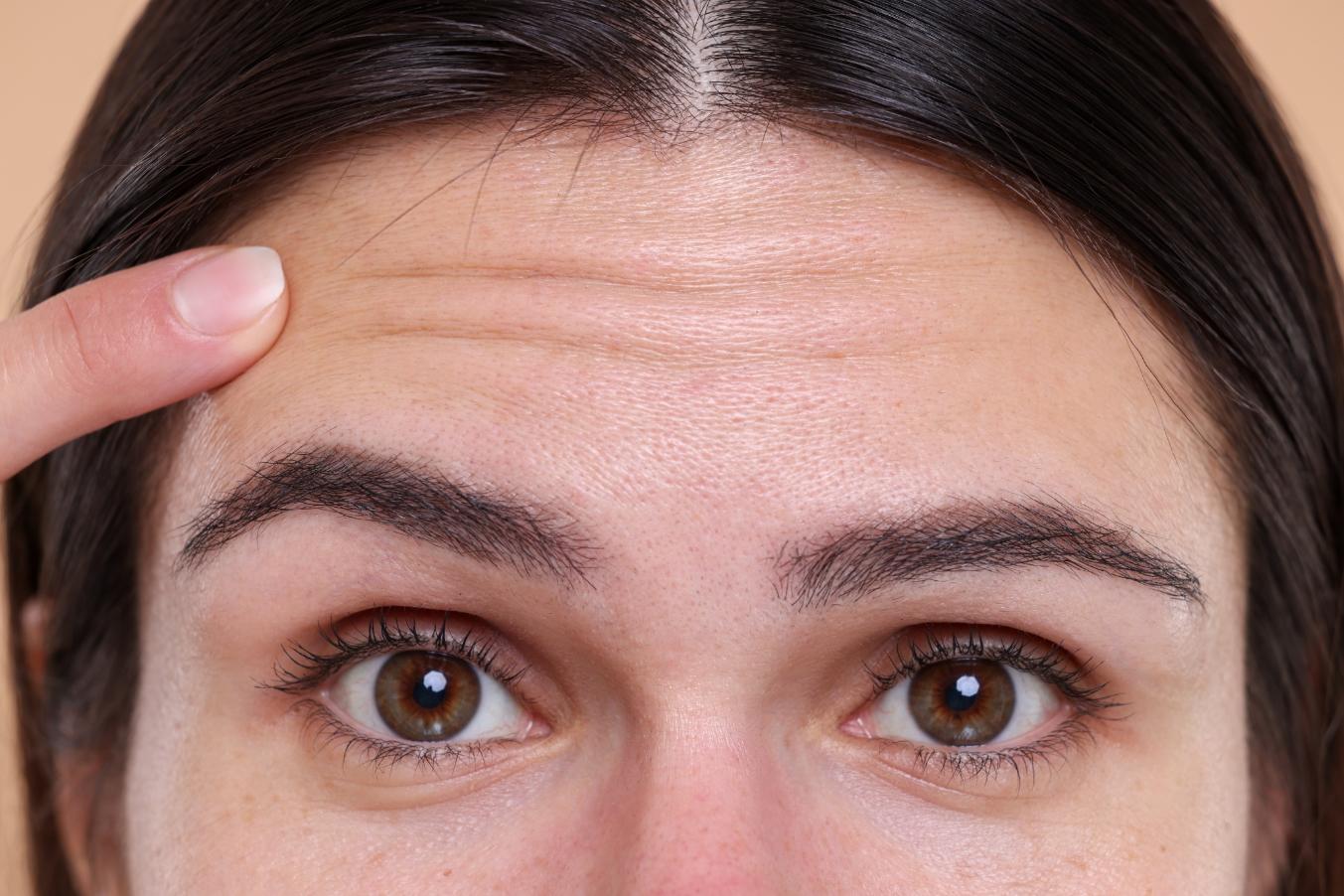 Girl pointing at her forehead lines